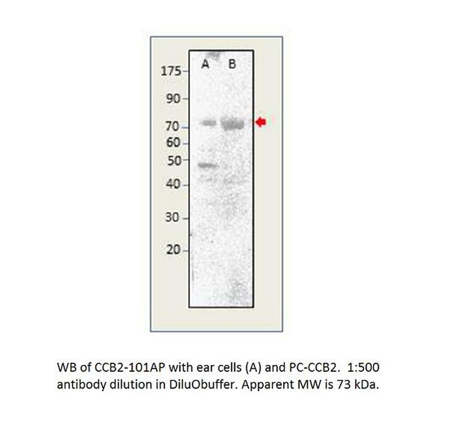 CACNB2 Antibody in Western Blot (WB)