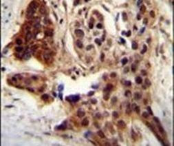 CCDC122 Antibody in Immunohistochemistry (IHC)
