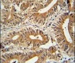 CCDC123 Antibody in Immunohistochemistry (IHC)