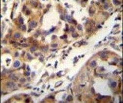 CCDC17 Antibody in Immunohistochemistry (IHC)