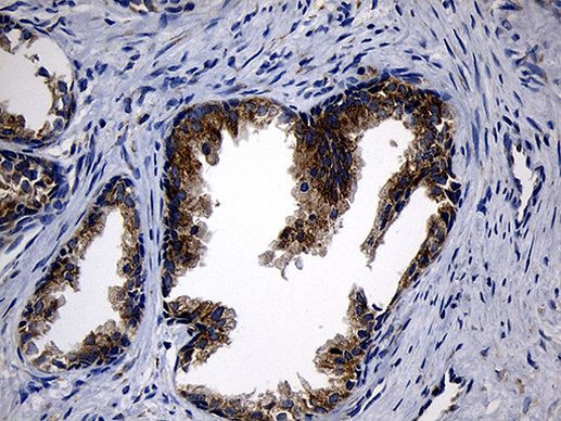 CCDC22 Antibody in Immunohistochemistry (Paraffin) (IHC (P))