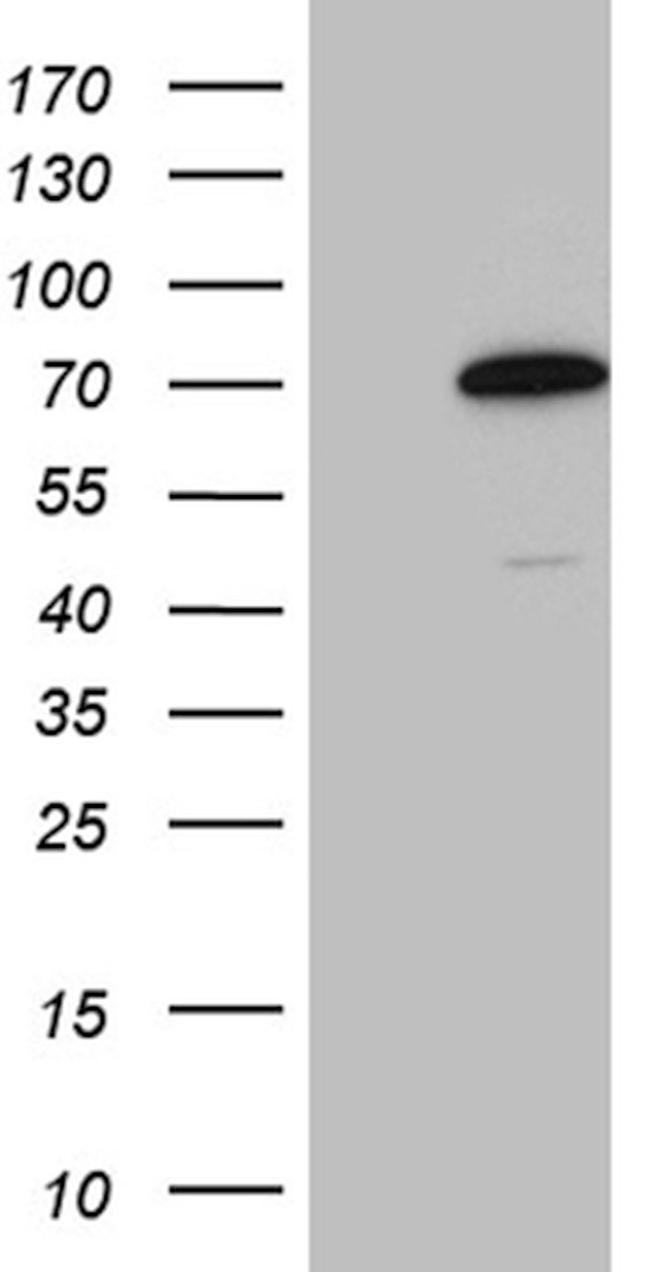 CCDC22 Antibody in Western Blot (WB)