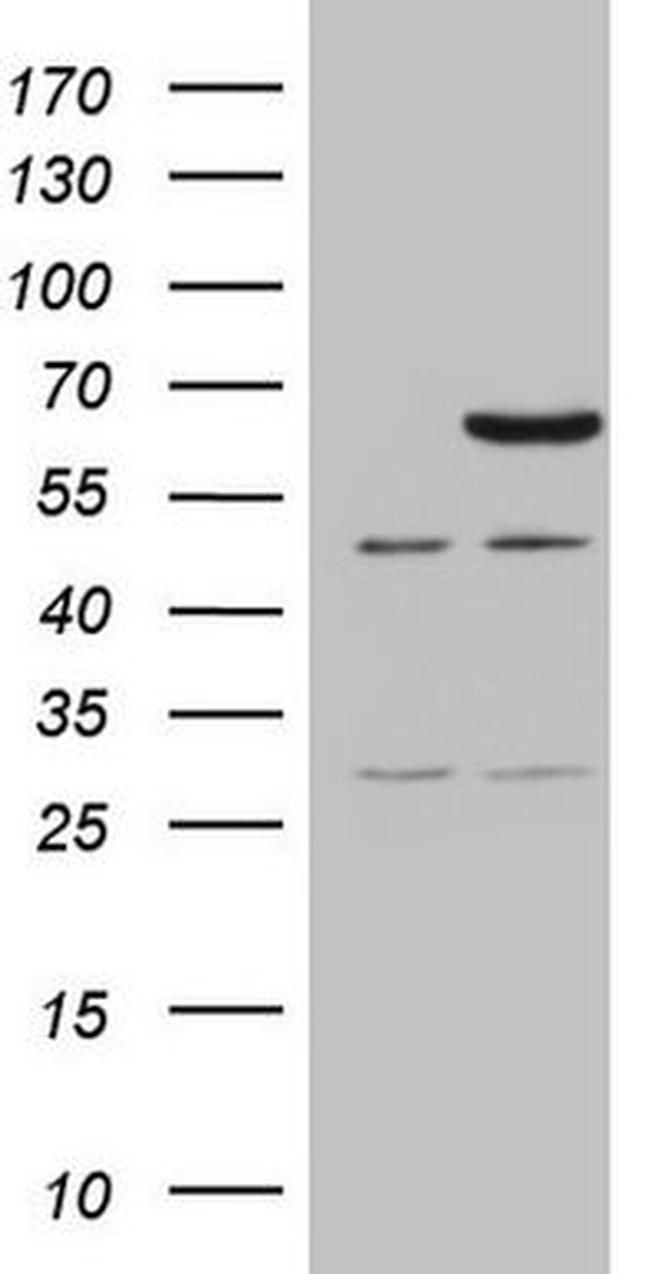 CCDC36 Antibody in Western Blot (WB)
