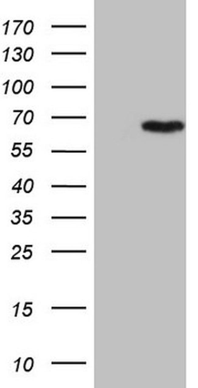 CCDC36 Antibody in Western Blot (WB)
