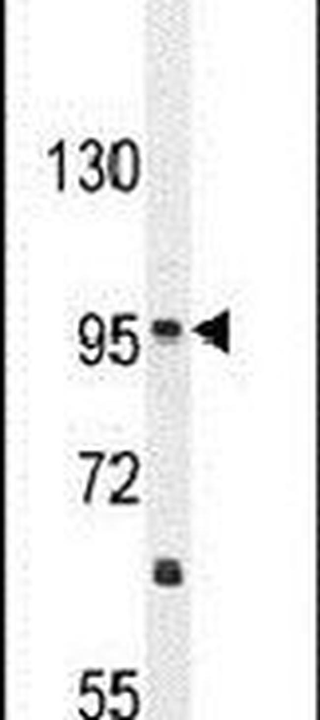 CCDC39 Antibody in Western Blot (WB)