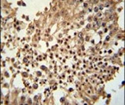 CCDC42 Antibody in Immunohistochemistry (IHC)