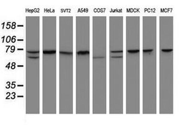 CCDC93 Antibody in Western Blot (WB)