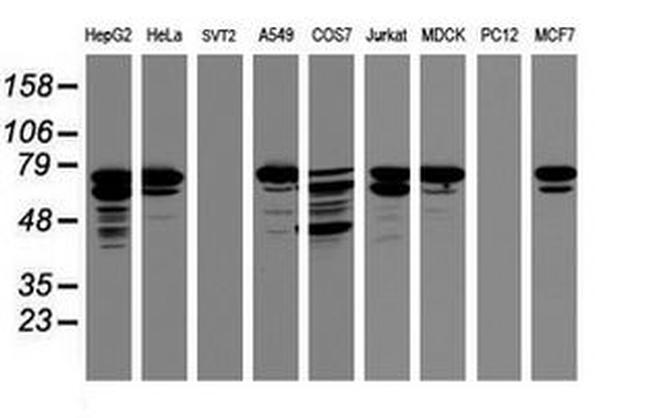 CCDC93 Antibody in Western Blot (WB)