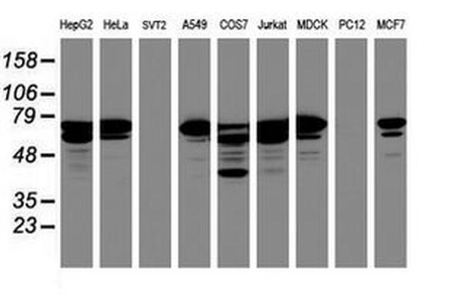 CCDC93 Antibody in Western Blot (WB)