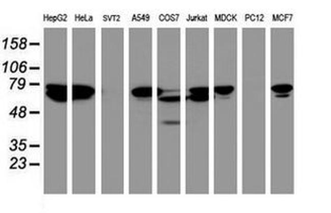 CCDC93 Antibody in Western Blot (WB)