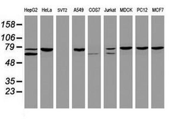 CCDC93 Antibody in Western Blot (WB)