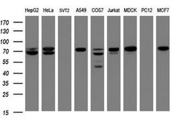 CCDC93 Antibody in Western Blot (WB)