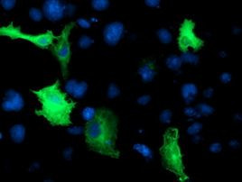 CCM2 Antibody in Immunocytochemistry (ICC/IF)