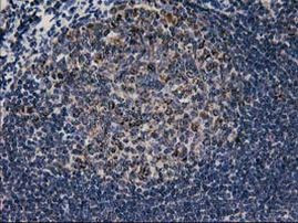CCM2 Antibody in Immunohistochemistry (Paraffin) (IHC (P))