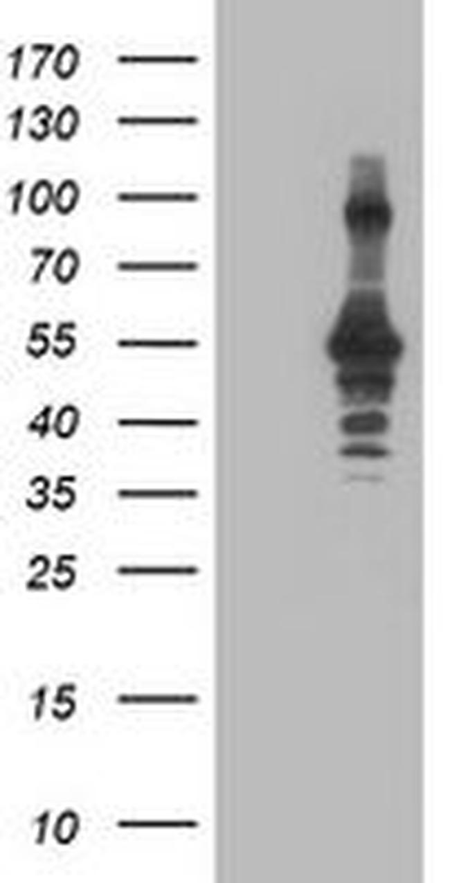 CCM2 Antibody in Western Blot (WB)