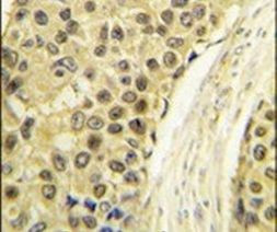 Cyclin A2 Antibody in Immunohistochemistry (IHC)