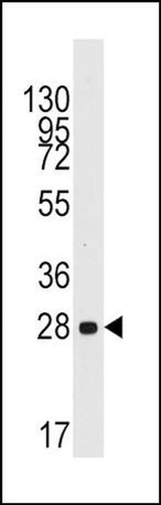 Cyclin D1 Antibody in Western Blot (WB)