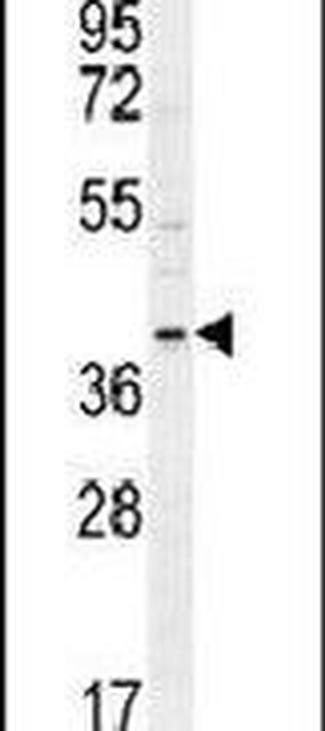 Cyclin G1 Antibody in Western Blot (WB)