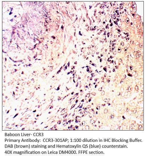CCR3 Antibody in Immunohistochemistry (Paraffin) (IHC (P))