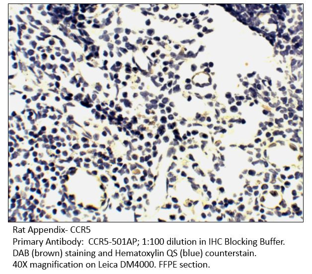 CCR5 Antibody in Immunohistochemistry (IHC)
