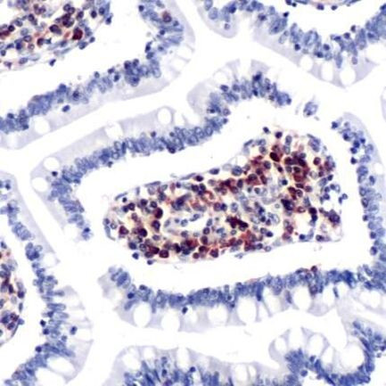 CCR7 Antibody in Immunohistochemistry (IHC)