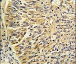 TCP-1 gamma Antibody in Immunohistochemistry (IHC)