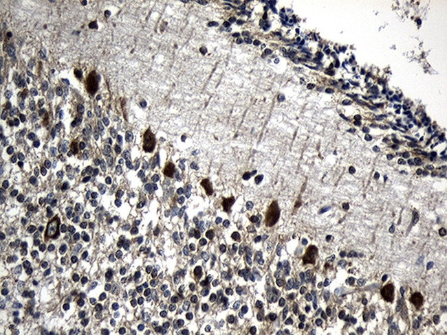 CCT4 Antibody in Immunohistochemistry (Paraffin) (IHC (P))