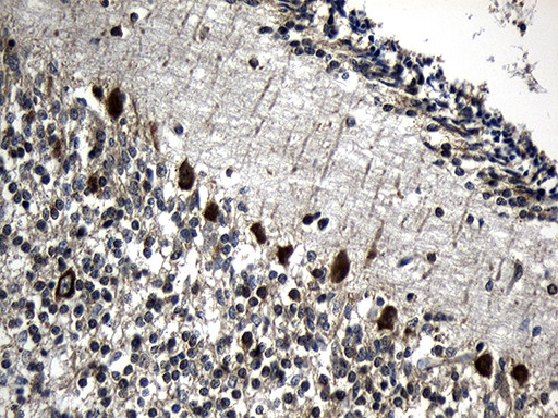 CCT4 Antibody in Immunohistochemistry (Paraffin) (IHC (P))