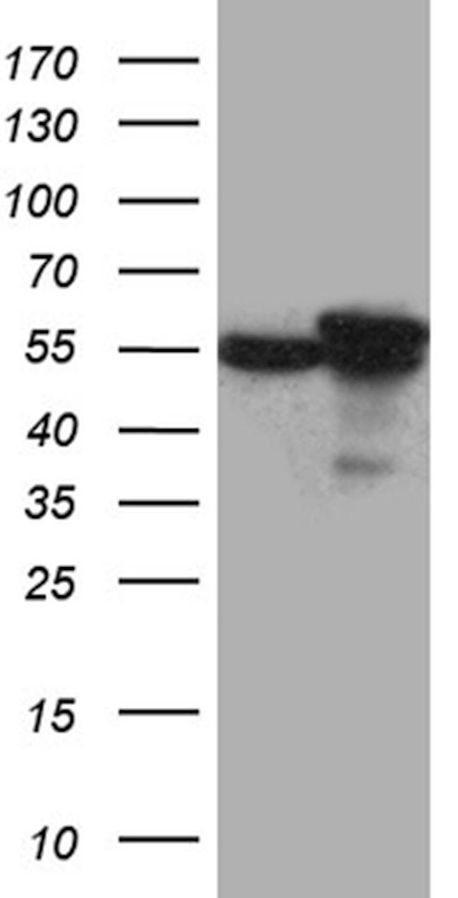 CCT4 Antibody in Western Blot (WB)