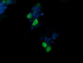 CCT8L2 Antibody in Immunocytochemistry (ICC/IF)