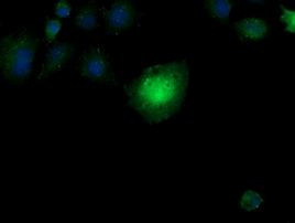 CCT8L2 Antibody in Immunocytochemistry (ICC/IF)