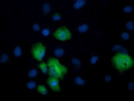CCT8L2 Antibody in Immunocytochemistry (ICC/IF)