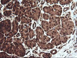 CCT8L2 Antibody in Immunohistochemistry (Paraffin) (IHC (P))