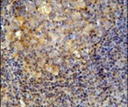 CD10 Antibody in Immunohistochemistry (IHC)