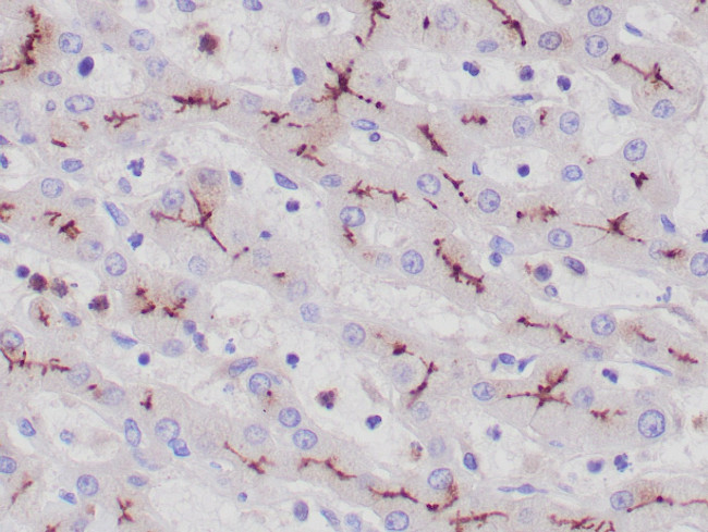CD10 Antibody in Immunohistochemistry (Paraffin) (IHC (P))