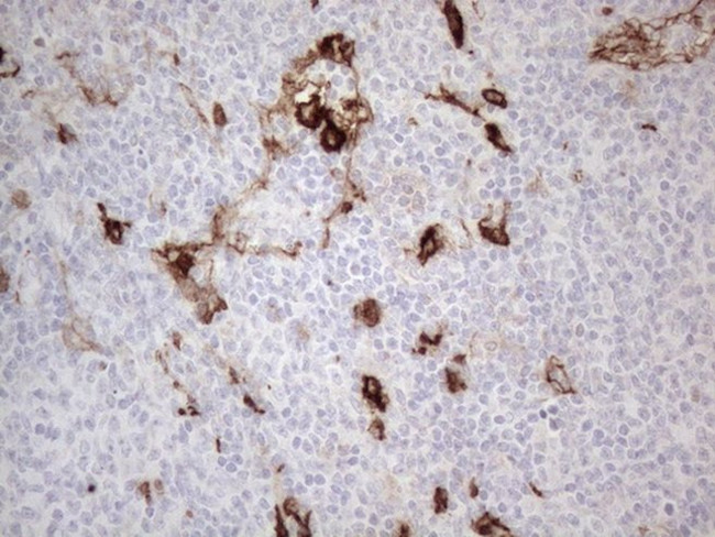 CD13 Antibody in Immunohistochemistry (Paraffin) (IHC (P))