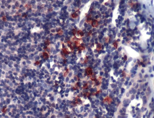 CD138 Antibody in Immunohistochemistry (IHC)