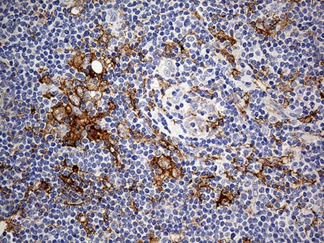 CD14 Antibody in Immunohistochemistry (Paraffin) (IHC (P))