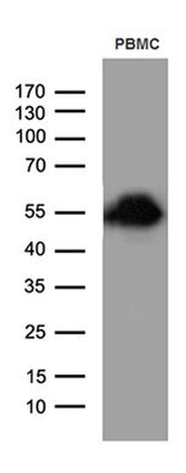 CD14 Antibody in Western Blot (WB)