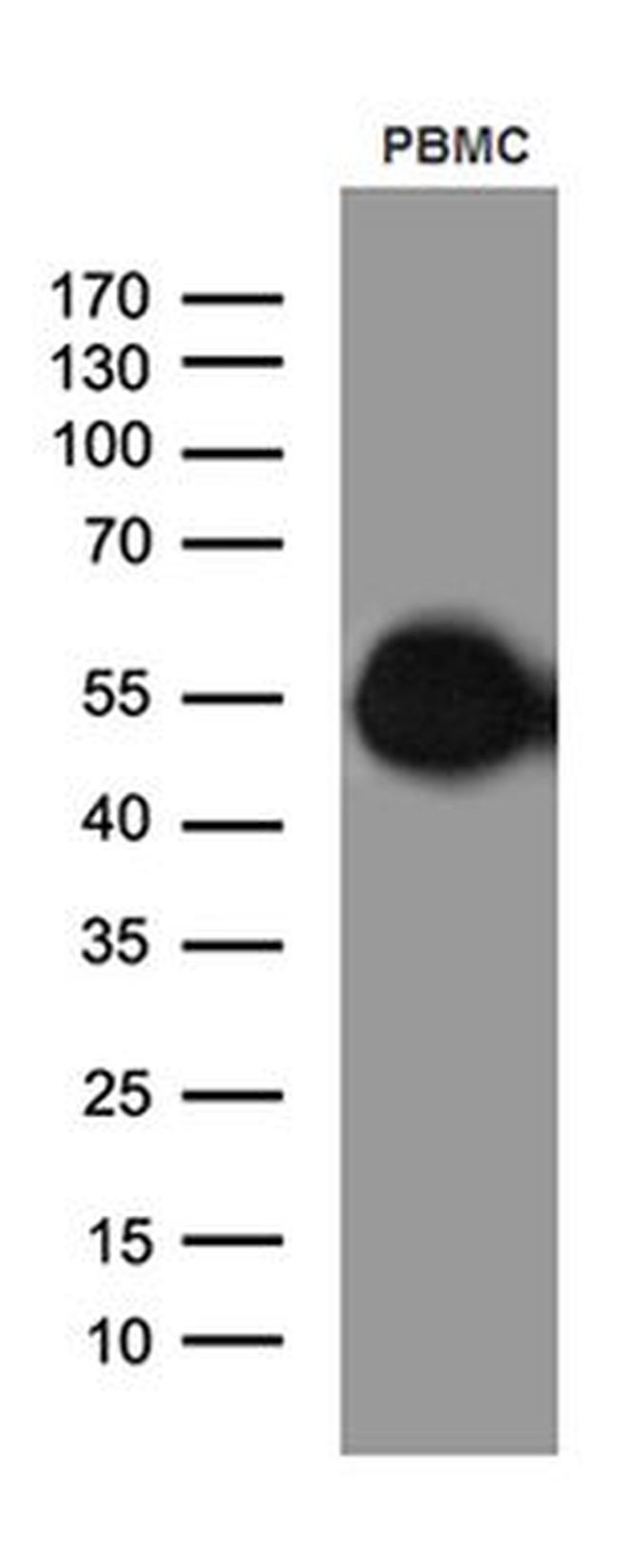 CD14 Antibody in Western Blot (WB)