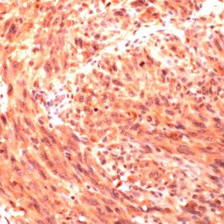 CD146 Antibody in Immunohistochemistry (IHC)