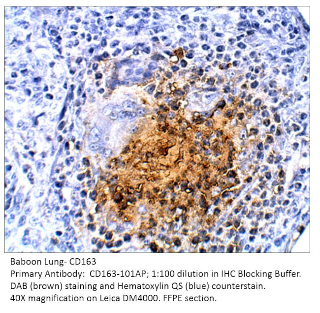 CD163 Antibody in Immunohistochemistry (IHC)