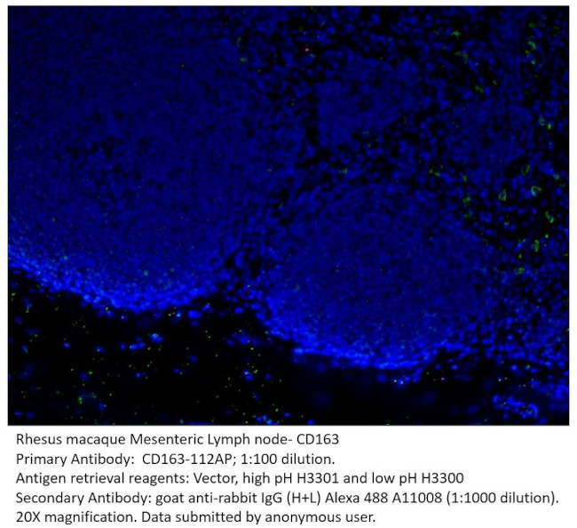CD163 Antibody in Immunohistochemistry (IHC)