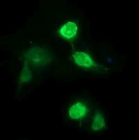 CD163 Antibody in Immunocytochemistry (ICC/IF)