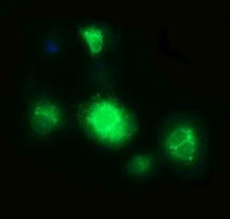 CD163 Antibody in Immunocytochemistry (ICC/IF)