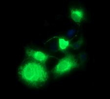 CD163 Antibody in Immunocytochemistry (ICC/IF)