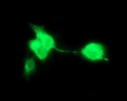 CD163 Antibody in Immunocytochemistry (ICC/IF)