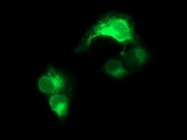CD163 Antibody in Immunocytochemistry (ICC/IF)