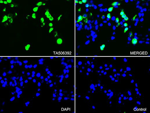 CD163 Antibody in Immunocytochemistry (ICC/IF)