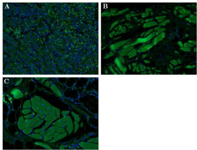 CD163 Antibody in Immunohistochemistry (Paraffin) (IHC (P))